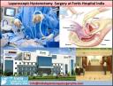  Laparoscopic Hysterectomy surgery in India logo